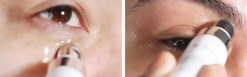 GEL PARA OJOS DESINFLAMANTE CAFEÍNA Y ÁCIDO HIALURÓNICO - MOIRA